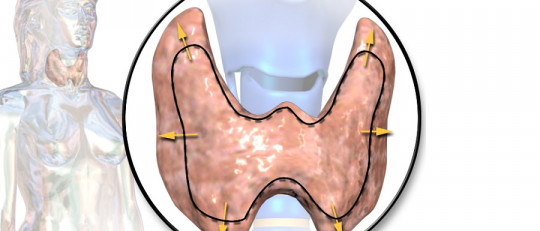 Encefalopatía de Hashimoto