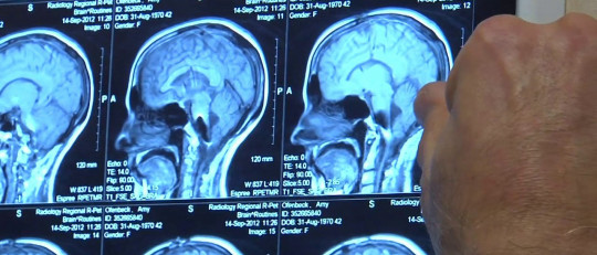 Los límites y fallos de la memoria humana