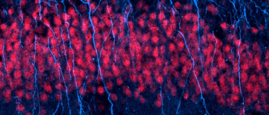 Neurogénesis: ¿cómo se crean nuevas neuronas?