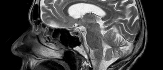 Criptomnesia: cuando tu cerebro se plagia a sí mismo