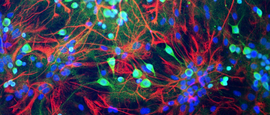 Tren de potenciales de acción