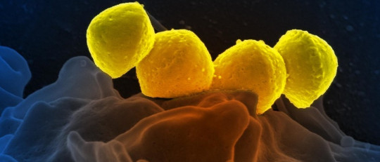 Características del reino monera