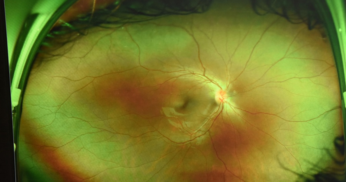Partes de la retina capas y células que la componen Partes de la retina capas y células que la componen