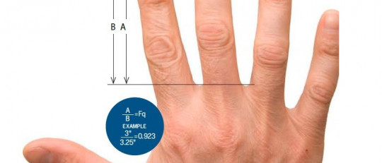 La longitud de los dedos indicaría el riesgo de sufrir esquizofrenia