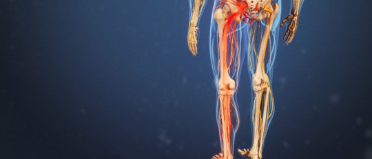 Nervio isquiático (ciático)