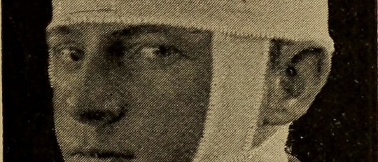 Síndrome del área motora suplementaria