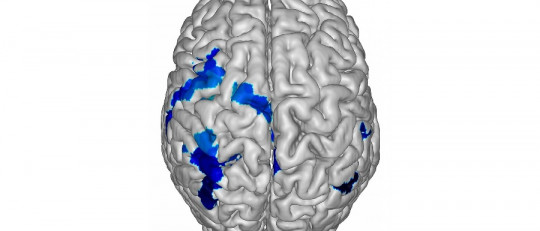 Hemisferio cerebral izquierdo