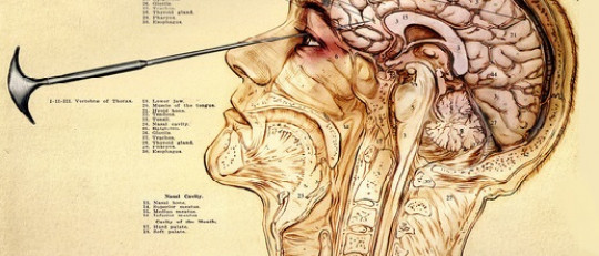 ¿Qué es una lobotomía y con qué finalidad se practicaba?