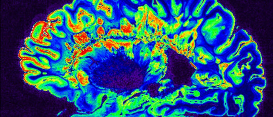 Neurobiología del TDAH