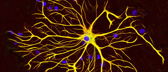 Células gliales: mucho más que el pegamento de las neuronas