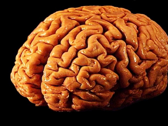 La psicoterapia produce cambios en el cerebro