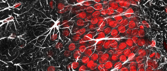 El papel de la glía en la enfermedad neurológica