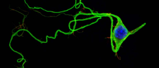 Potencial de membrana en reposo