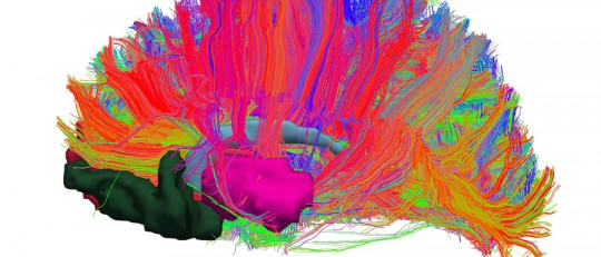 Sistema de recompensa del cerebro: ¿qué es y cómo funciona?