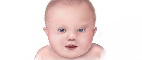 Tipos de discapacidad intelectual (y características)