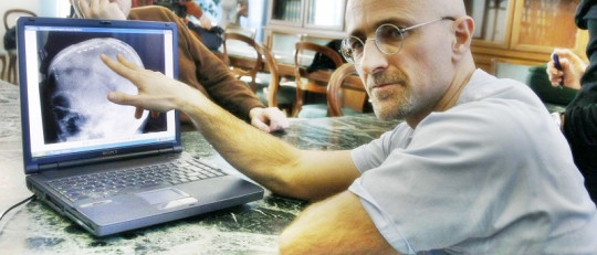 El trasplante de cabeza en humanos: ¿qué dice la ciencia al respecto?