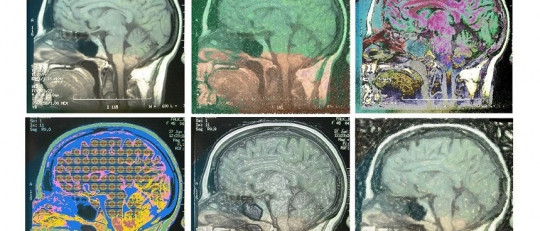 Las personas curiosas son más inteligentes y aprenden mejor