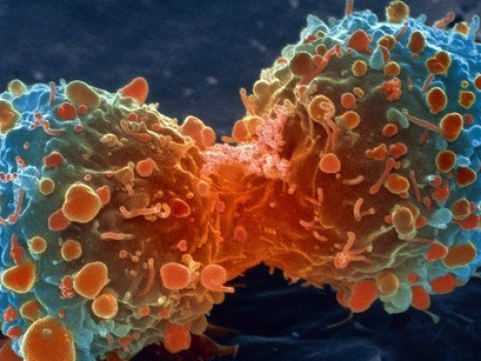 10 mitos populares sobre el cáncer (y por qué son falsos)