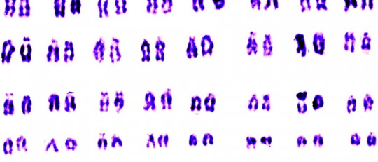 Síndromes cromosómicos