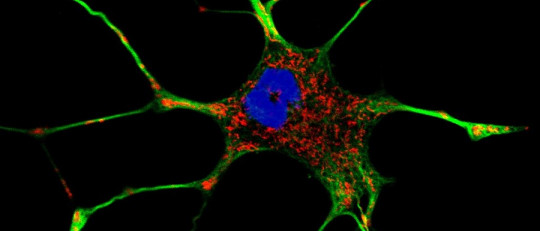 Citoesqueleto de la neurona