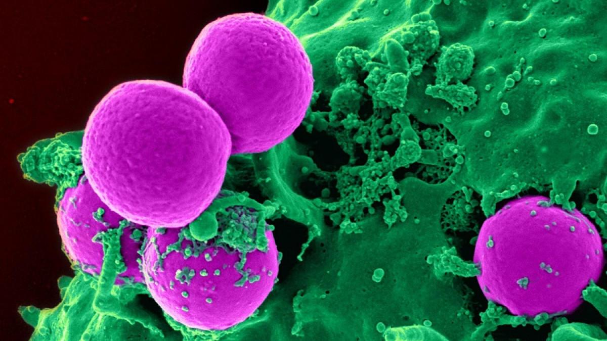 Mikroszkopikus Evez Lap T Clasificacion De Las Bacterias Segun Su