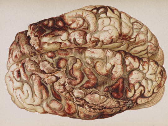 Cordero Inodoro Nevada Las 12 enfermedades del cerebro más importantes