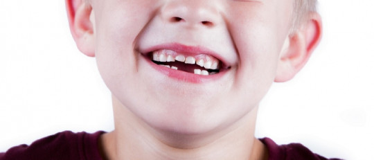 Síndrome de Angelman: causas, síntomas y tratamiento