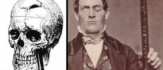 El curioso caso de Phineas Gage y la barra de metal en la cabeza