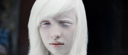 Personas albinas: genética y problemas que sufren en distintas partes del mundo