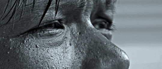 Hipocondría: causas, síntomas y posibles tratamientos