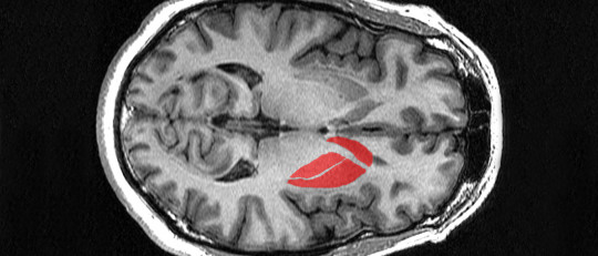 Cuerpo estriado: estructura, funciones y trastornos asociados