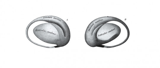 Núcleo caudado: características, funciones y trastornos