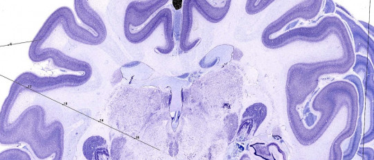 Los 3 tipos de memoria sensorial: icónica, ecoica y háptica