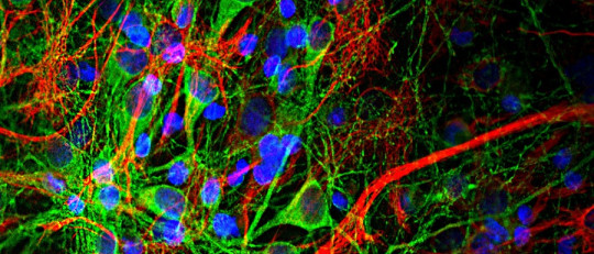 ¿Cómo funcionan las neuronas?