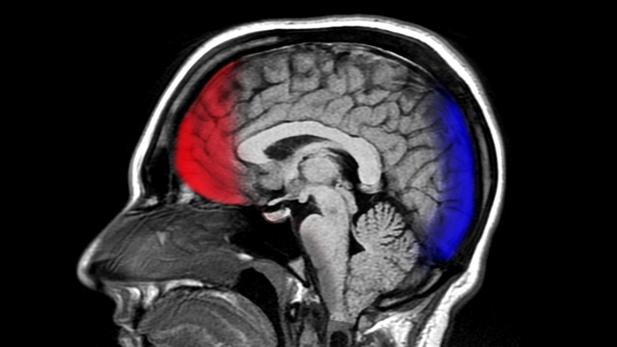 Las 5 principales tecnologías para el estudio del cerebro, image size:1200x675