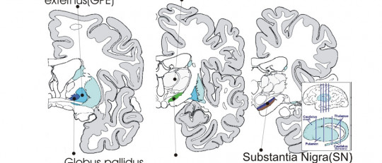 Subtálamo: partes, funciones y trastonos asociados