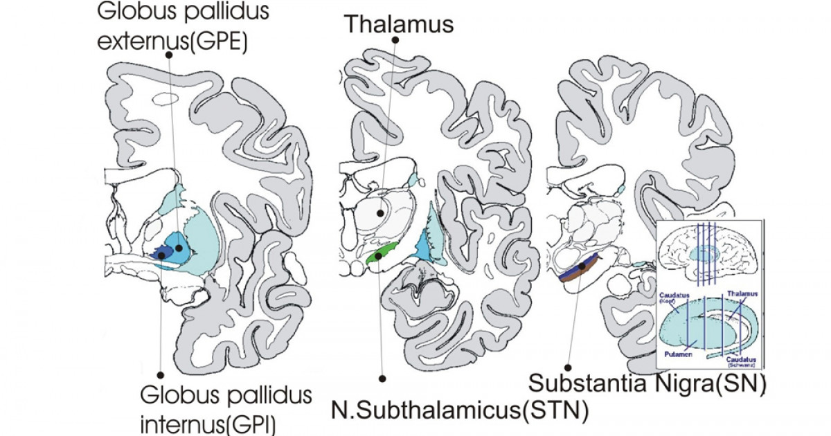 Subtálamo partes, funciones y trastonos asociados