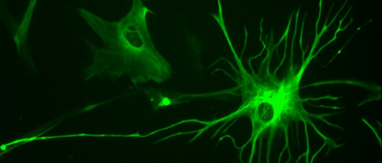 Astrocitos: ¿qué funciones cumplen estas células gliales?