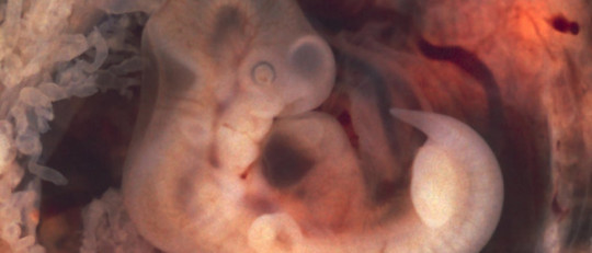 Las 3 fases del desarrollo intrauterino o prenatal: del cigoto al feto