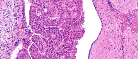 Plexos coroideos: anatomía, funciones y patologías