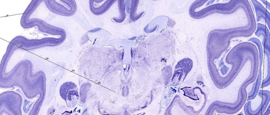Memoria semántica: funcionamiento y trastornos asociados
