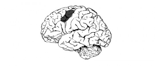 Afasia transcortical (sensorial, motora y mixta)