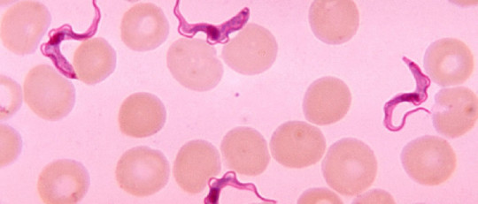 Enfermedad del sueño