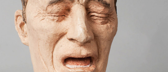 Disestesia: qué es este síntoma, causas y tipos