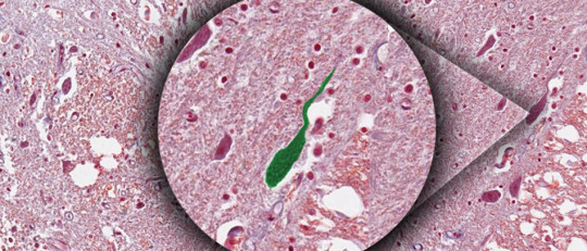 Neuronas unipolares: características, localización y funciones