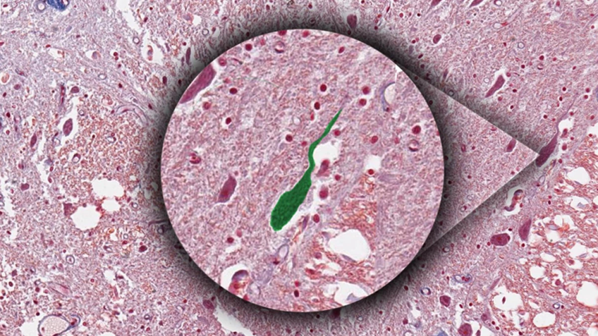 diagrama de neurona unipolar