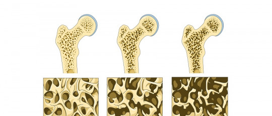 Enfermedades del sistema óseo