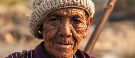 Diferencias entre demencia y Alzheimer