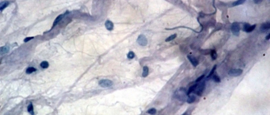 Tipos de edemas (según sus causas y síntomas principales)