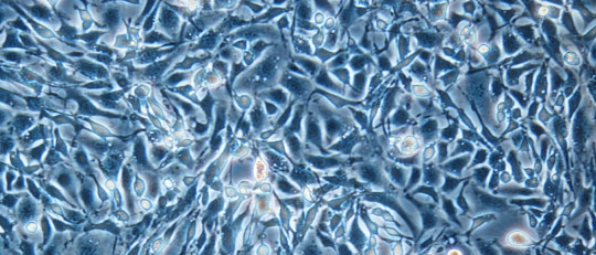 Enfermedad de Gaucher: síntomas, causas y tipos